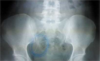 u0627u0634u0639u0629 u062au0628u0631u0632 u0648u062cu0648u062f u0627u0644u0627u0628u0631u0629 u0641u064a u0631u062du0645 (u0646)