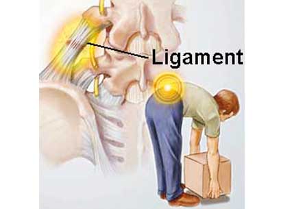 آلام الظهر تزداد حدة في أشهر البرد