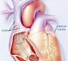 تضر بصحة القلب والشرايين