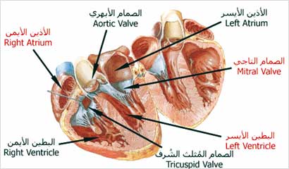 الحمى الروماتيزمية تتلف صمامات القلب 