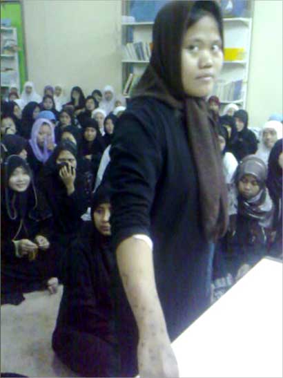 خادمة تعرض اثار التعذيب على يدها 