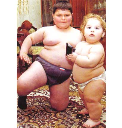 سمنة الأطفال بلغت معدلات مخيفة في دول العالم المتقدم