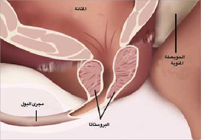 معاناة تضخم غدة البروستاتا تزداد في أيام الشتاء