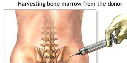 u0639u0644u0627u062c u062cu062fu064au062f u0644u0644u0639u0642u0645 u064au062du062au0627u062c u0644u0631u0623u064a u0627u0644u0634u0631u0639