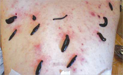 u0644u0639u0627u0628 u062fu064au062fu0627u0646 u0627u0644u0639u0644u0642 u064au0639u0627u0644u062c u0623u0645u0631u0627u0636u0627u064b u0643u062bu064au0631u0629