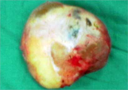 u0627u0644u0648u0631u0645 u0627u0644u0645u0633u062au0623u0635u0644