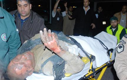 أحد المصابين الذي تم انتشاله من تحت الانقاض