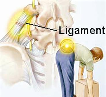 آلام الظهر تكثر الاصابة بها هذه الايام