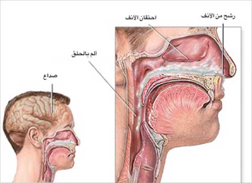 الرشح والعطس من أعراض نزلات البرد