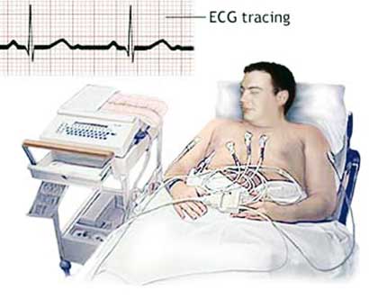 الفحص يرسم القلب الكهربائي لاكتشاف حالات المرض 