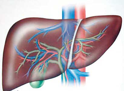 تناول الباراسيتمول «ادول - بنادول» مع القهوة مضر بالكبد