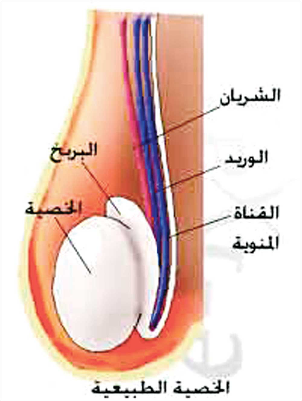 التهاب الخصية من مضاعفات النكاف