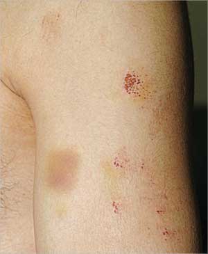  ... وعلى ذراعه (تصوير نور هنداوي)