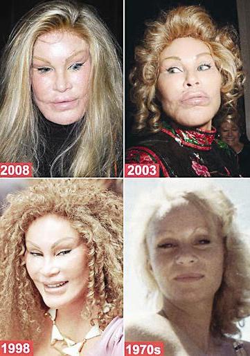 هكذا فعلت عمليات التجميل بوجه سيدة المجتمع السويسرية جوسلين ويلدنشتاين