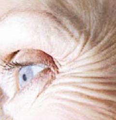 شكوك حيال فعالية هرمون الأنوثة في المحافظة على نضارة الجلد