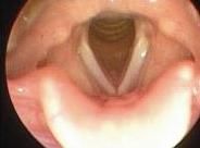 طول وسمك الأحبال الصوتية يتحكم في قوة الصوت