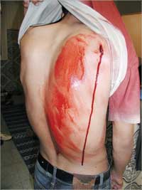 نموذج صارخ للعنف بين الطلاب