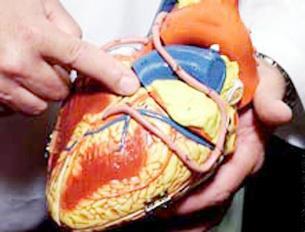 من هم مرضى القلب الذين رُخص لهم بالإفطار؟