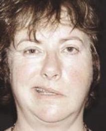 u062au0643u062bu0631 u0627u0644u0625u0635u0627u0628u0629 u0628u0634u0644u0644 u0639u0635u0628 u0627u0644u0648u062cu0647 u0641u064a u0641u0635u0644 u0627u0644u0634u062au0627u0621r