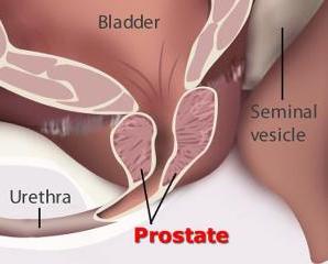 معاناة تضخم البروستاتا تزداد في أيام الشتاء