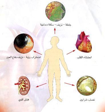 مضاعفات مرض السكري