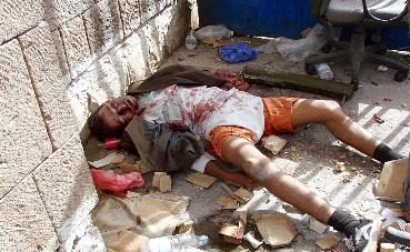 جثة يمني ملقاة في أحد شوارع صنعاء 		(أ ف ب)