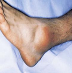 u0627u0644u062au0648u0627u0621 u0627u0644u0642u062fu0645r