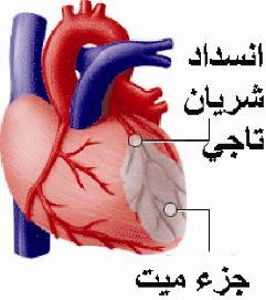 استخدام الخلايا الجذعية بدلاً من زراعة ونقل قلب من متبرع
