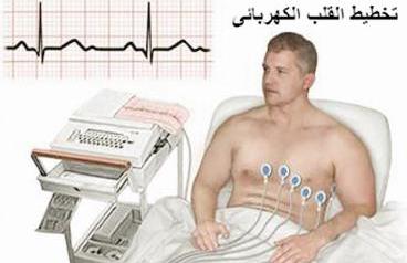 الزواج التعيس وراء الذبحة الصدرية ونوبات القلب