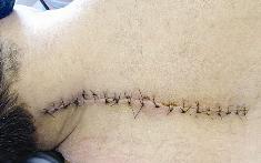 آثر الحادث على ظهر المقدم يوسف الشطي