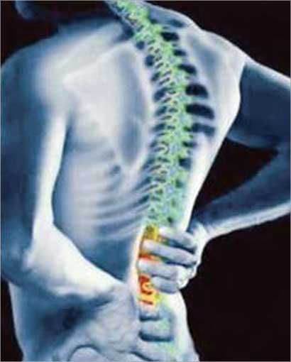 حمل أشياء ثقيلة يؤدي إلى تمزق أربطة فقرات الظهر