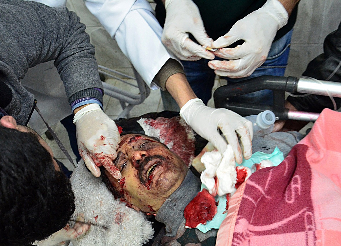 معالجة أحد جرحى التفجير (ا ف ب)