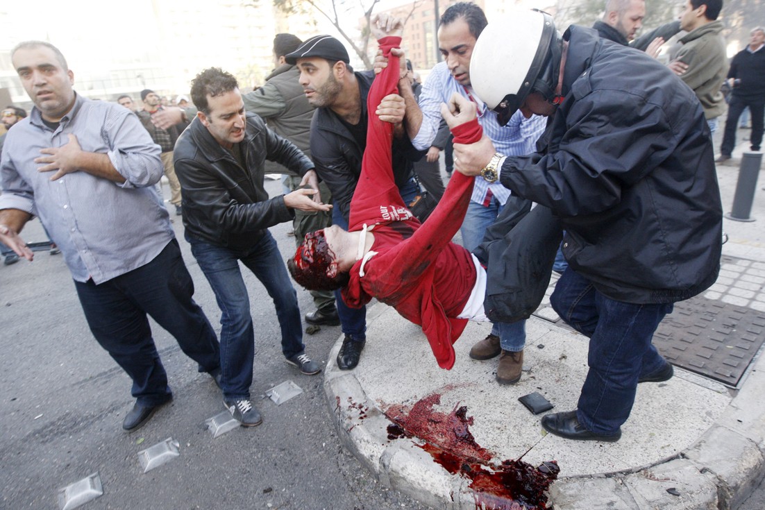 u0645u062du0645u062f u0645u0636u0631u062cu0627u064b u0628u062fu0645u0627u0626u0647 u0641u064a u0645u0633u0631u062d u0627u0644u062cu0631u064au0645u0629