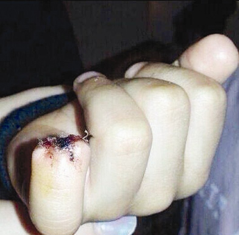 u0625u0635u0628u0639 u0627u0644u0637u0627u0644u0628 u0627u0644u0645u0635u0627u0628