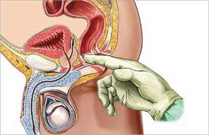 معاناة تضخم البروستاتا تزداد حدة في الشتاء