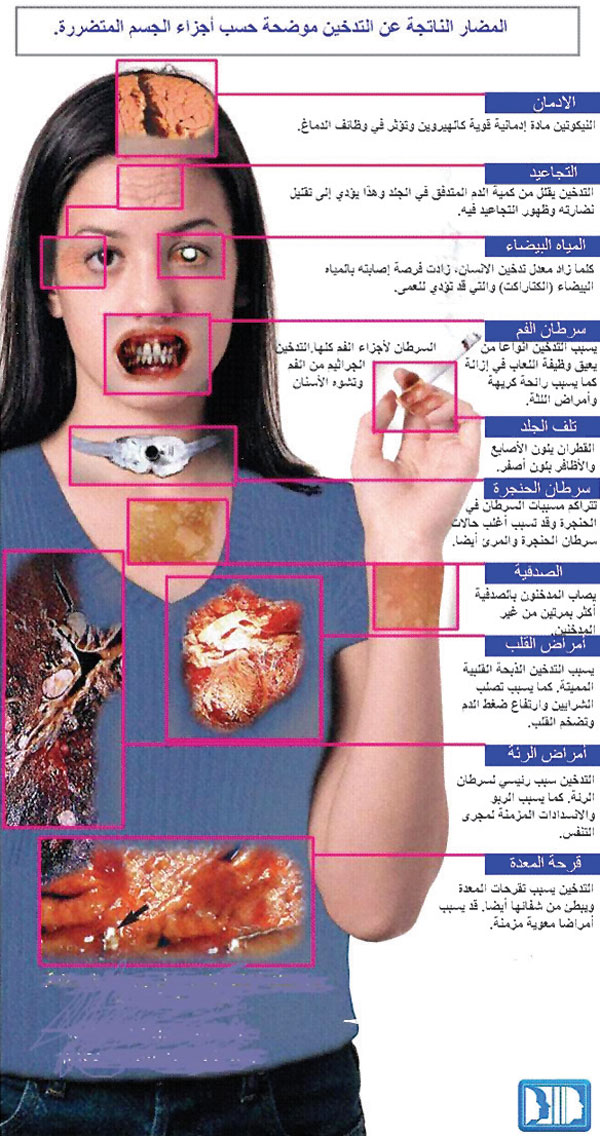 التدخين من مصادر الشوارد الحرة التي تتلف خلايا أجهزة الجسم