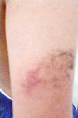 أثر الضرب على يد محمد