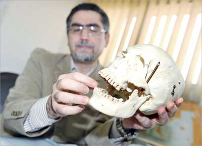 وليد رنو ممسكا بـ «جمجمة» ويشرح الفم والأسنان