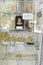 مخ محنط ومحفوظ