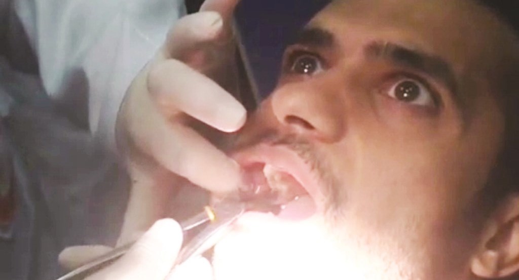 نواف الخالدي يخلع ضرس العقل