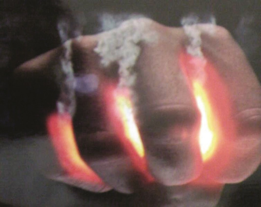 u0627u0644u063au0636u0628 u062cu0645u0631u0629 u0645u0646 u0627u0644u0634u064au0637u0627u0646