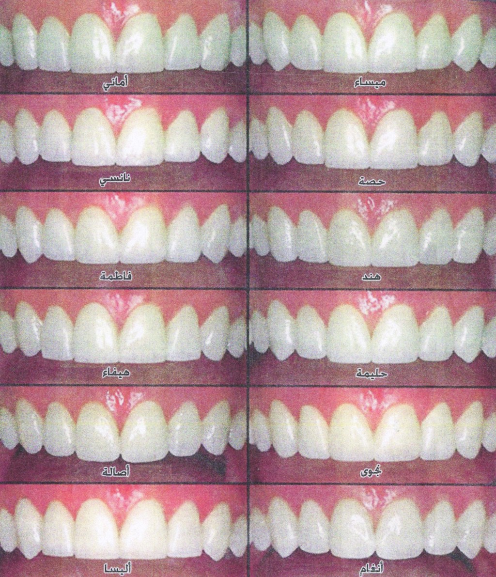 قائمة بنوعيات التقويمات التي يحمل كل واحد منها اسماً