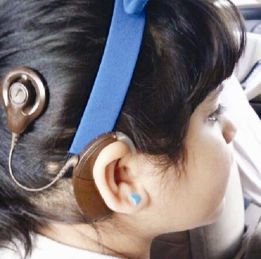 u062au0631u0643u064au0628 u0627u0644u062cu0647u0627u0632 u062eu0644u0641 u0627u0644u0631u0623u0633