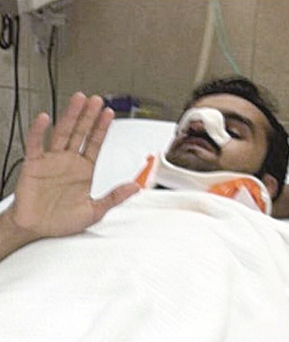 أحمد عبدالغفور بعد إصابته