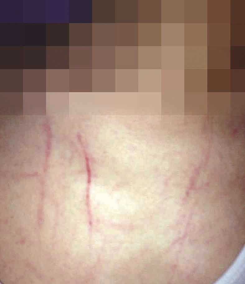 u0627u062bu0627u0631 u0627u0644u0627u0639u062au062fu0627u0621 u0639u0644u0649 (u0635)