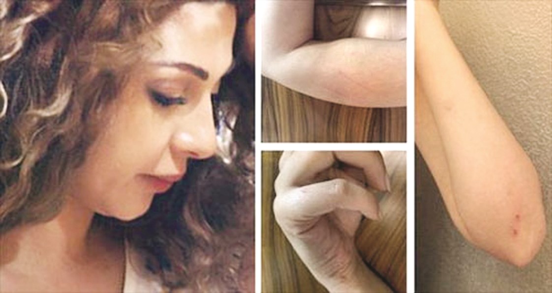 u0622u062bu0627u0631 u0627u0644u0627u0639u062au062fu0627u0621 u0639u0644u0649 u062cu0633u062f u0645u064au0631u064au0627u0645