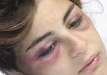 u062au0645u0627u0631u0627 u0641u064a u0627u0644u0645u0633u062au0634u0641u0649