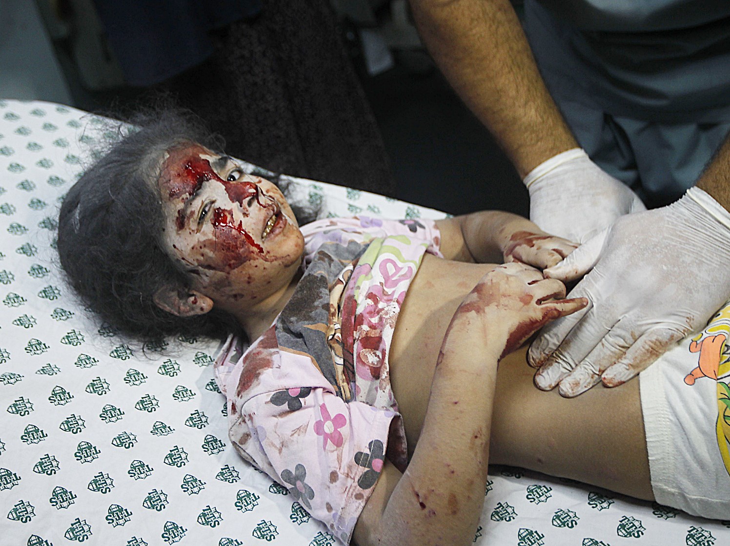 u0637u0641u0644u0629 u0645u0635u0627u0628u0629 u0627u062bu0631 u0642u0635u0641 u0627u0633u0631u0627u0626u064au0644u064a u062au062au0644u0642u0649 u0627u0644u0639u0644u0627u062c u0641u064a u0645u0633u062au0634u0641u0649 u062eu0627u0646 u064au0648u0646u0633  (u0627 u0641 u0628)