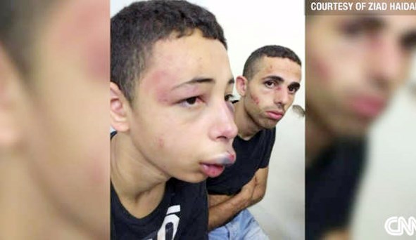 u0627u0644u0641u062au0649 u0637u0627u0631u0642 u0623u0628u0648 u062eu0636u064au0631 u0628u0639u062f u062au0639u0631u0636u0647 u0644u0644u0636u0631u0628 (u0633u064a u0627u0646 u0627u0646 u0627u0644u0639u0631u0628u064au0629)