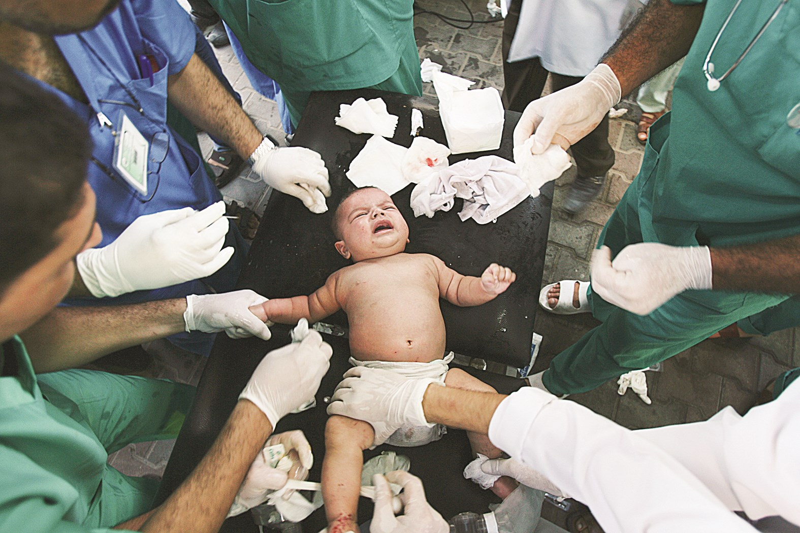 u00abu0627u0644u0623u064au0627u062fu064a u0627u0644u0628u064au0636u0627u0621u00bb u0645u0645u062au062fu0629 u0644u0645u0639u0627u0644u062cu0629 u0631u0636u064au0639 u0627u0635u064au0628 u0628u0634u0638u0627u064au0627 u0635u0627u0631u0648u062e u0627u0633u0631u0627u0626u064au0644u064a u0627u0633u062au0647u062fu0641 u0645u0646u0632u0644 u0630u0648u064au0647 u0641u064a u0631u0641u062d (u0627 u0628)